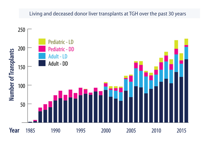 Living and deceased donor liver transplants
