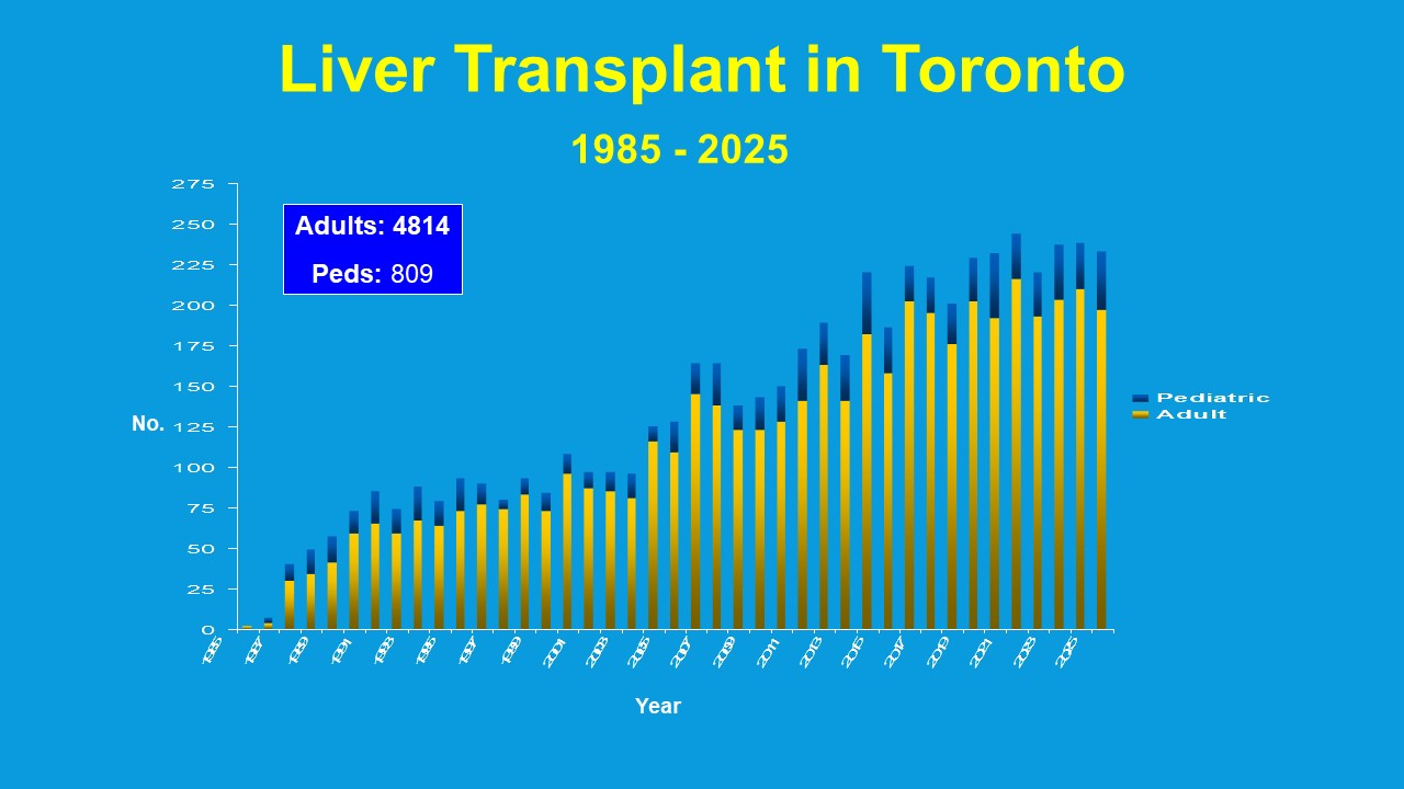 Living and deceased donor liver transplants